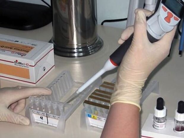 Laboratóriumi vizsgálatok a parazita betegségek diagnosztizálására
